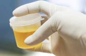 How to Collect A Urine Sample From A Dog How To Collect A Urine Sample From A Dog