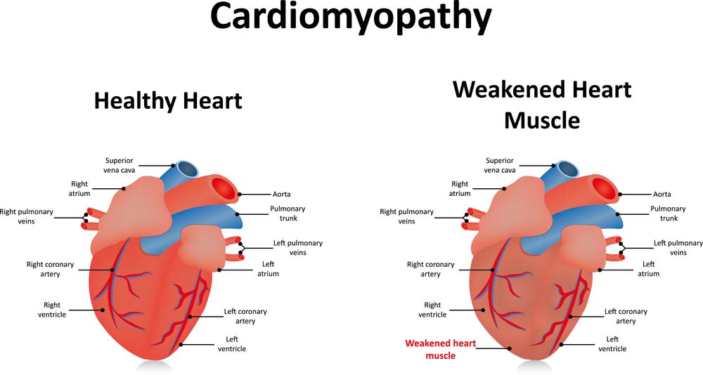 Enlarged Heart in Dogs (Cardiomyopathy) What You Must Know