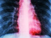 Woman Suffers Clinical Heartbreak After Her Dog’s Death Woman Suffers Clinical Heartbreak After Dog’s Death