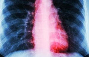 Woman Suffers Clinical Heartbreak After Her Dog’s Death Woman Suffers Clinical Heartbreak After Dog’s Death