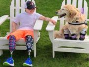 10-year Old Boy Amputee Meets Dog Amputee and It’s Love Boy Amputee Meets Dog Amputee and It’s Love