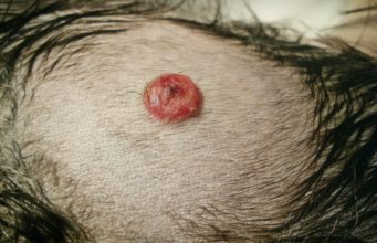 Hemangiosarcoma in Dogs: Everything You Must Know Hemangiosarcoma In Dogs