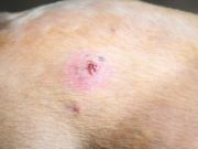 Bumps on a Dog’s Back: 7 Things It Could Be and What To Do Bumps on a Dogs Back - 7 Things It Could Be and What To Do