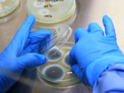 Mycotoxins In Dog Food – How Dangerous Can It Be? Mycotoxins In Dog Food – How Dangerous Can It Be